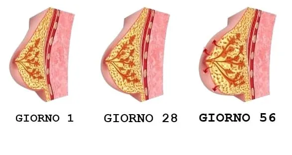 Volume seno aumentato con SenUp