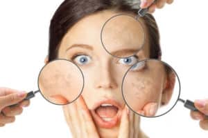 Fattori di stress per la pelle
